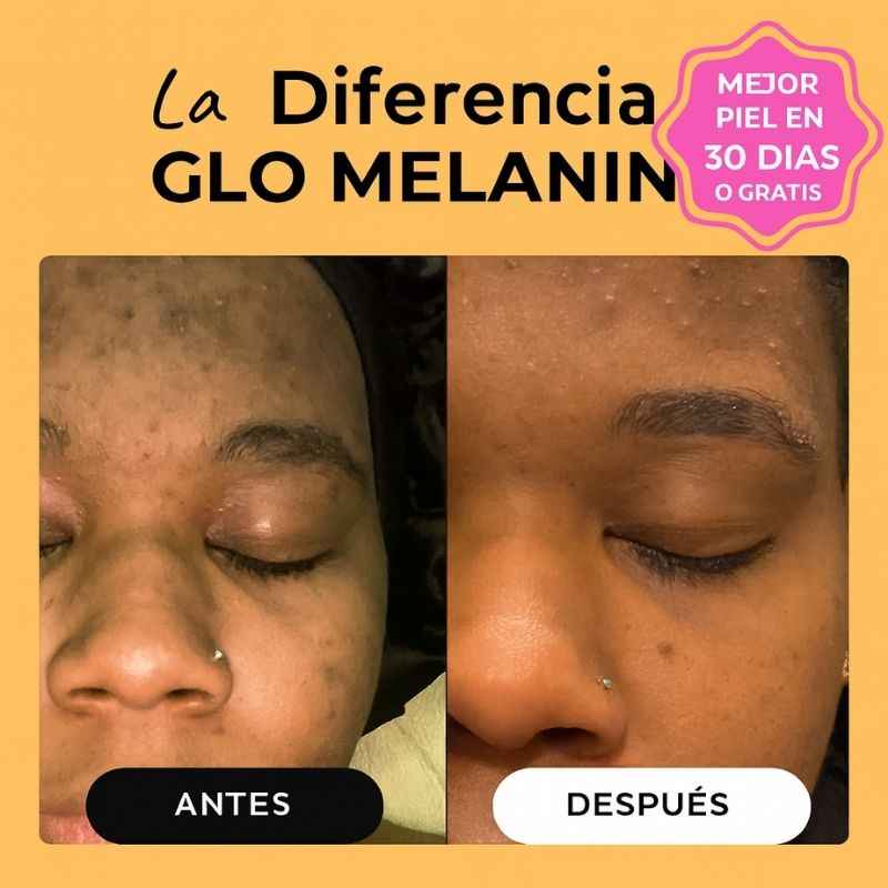Kit 3 jabones de cúrcuma orgánico para manchas oscuras