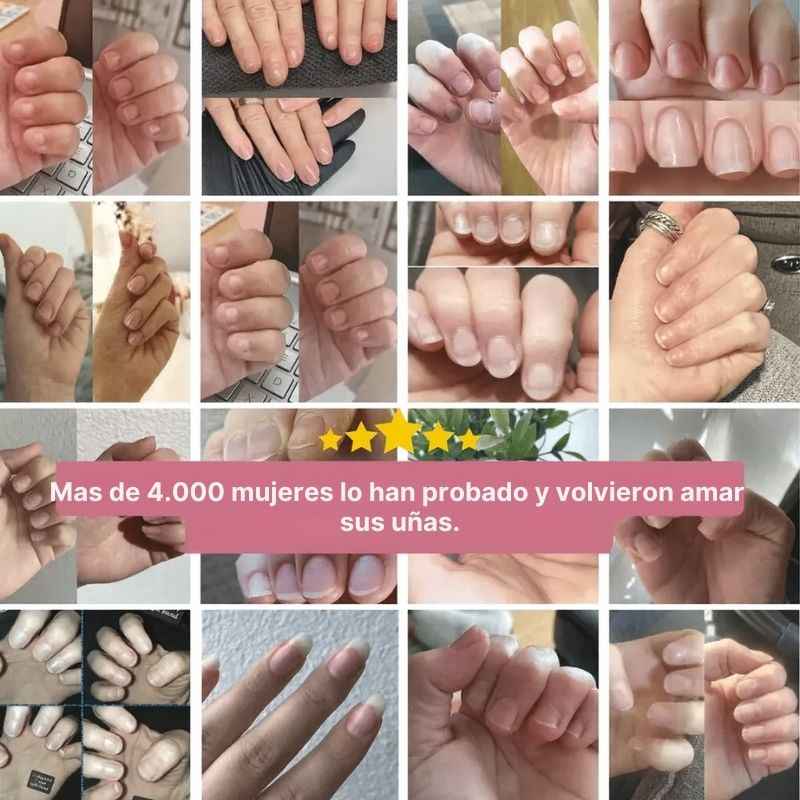 Nailix™: Lápiz para el crecimiento de uñas con células madre