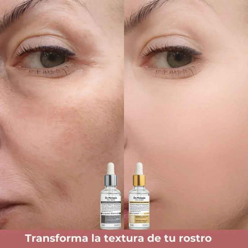 PeelShot™: Tratamiento Coreano exfoliante suave de Arroz negro
