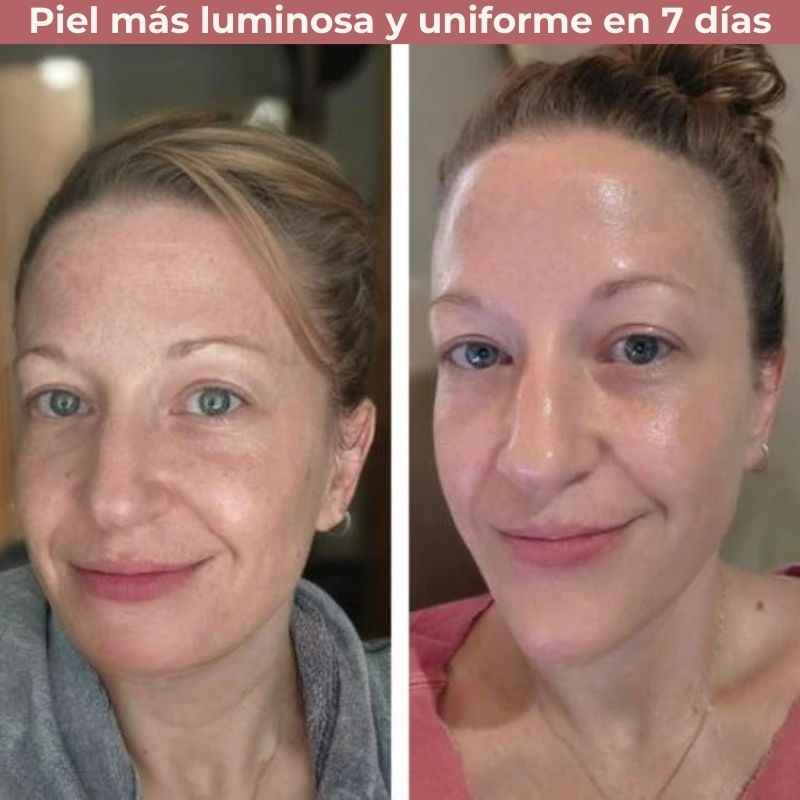 PeelShot™: Tratamiento Coreano exfoliante suave de Arroz negro