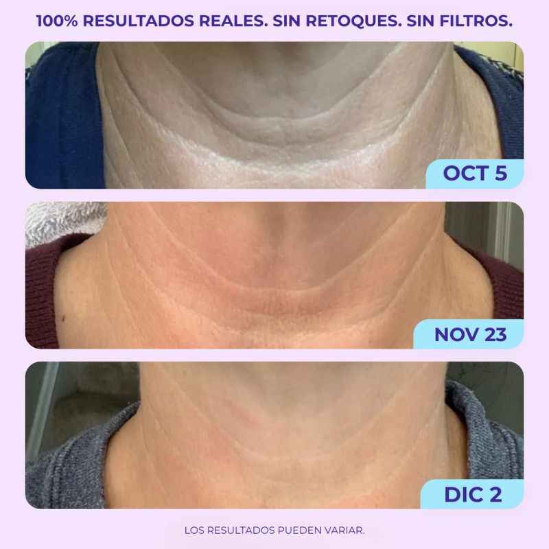 GoPure™: Crema reafirmante para cuello y escote