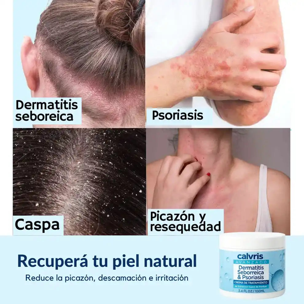 Calvris™: bálsamo natural que alivia y calma tu piel