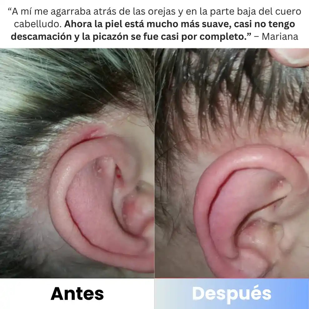 Calvris™: bálsamo natural que alivia y calma tu piel