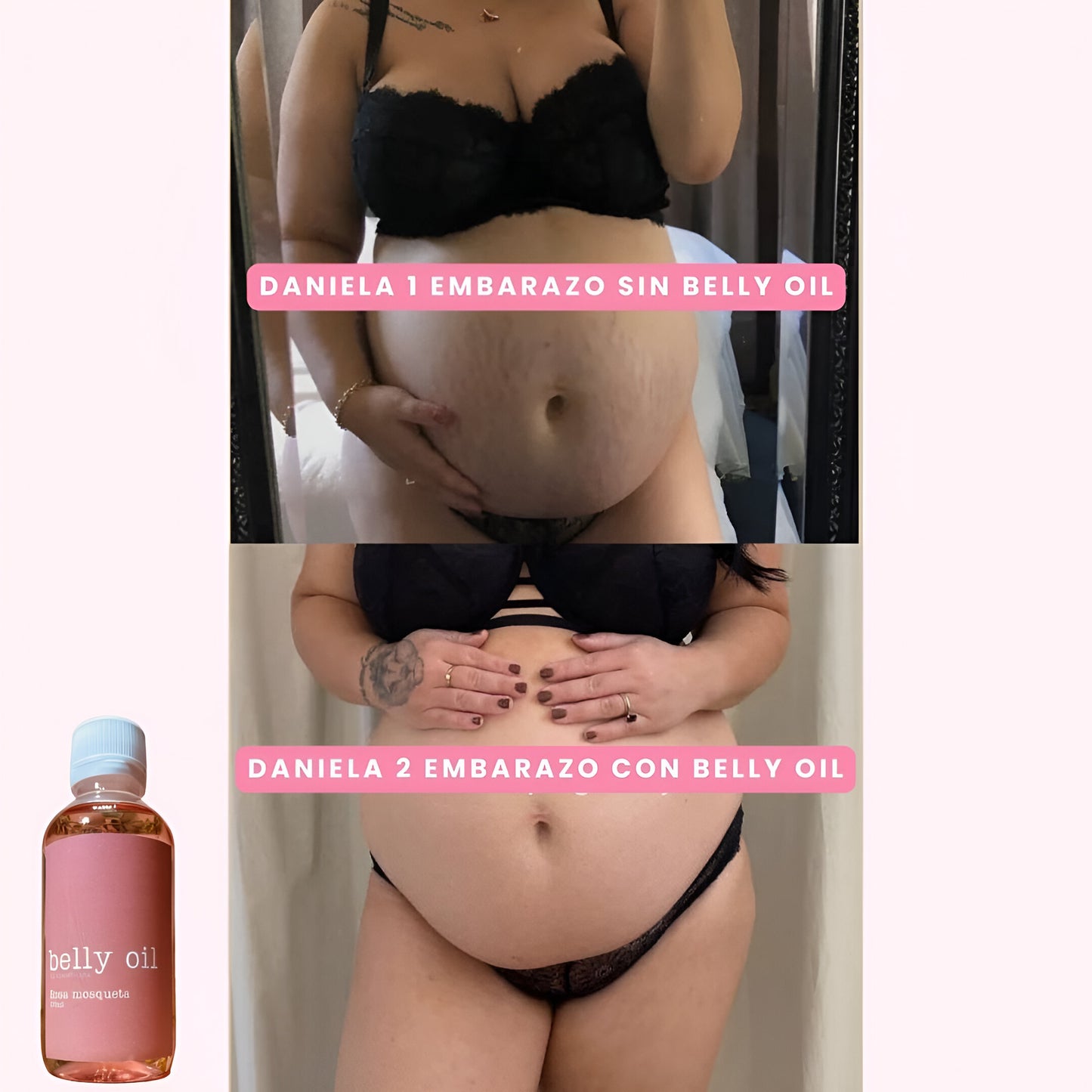 BELLY OIL™: ACEITE PARA PREVENIR Y ATENUAR LAS ESTRÍAS EN EL EMBARAZO 120ml.
