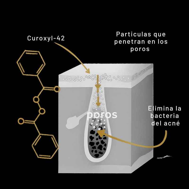 Shield™: Jabón Corporal para el Acné + Regalos