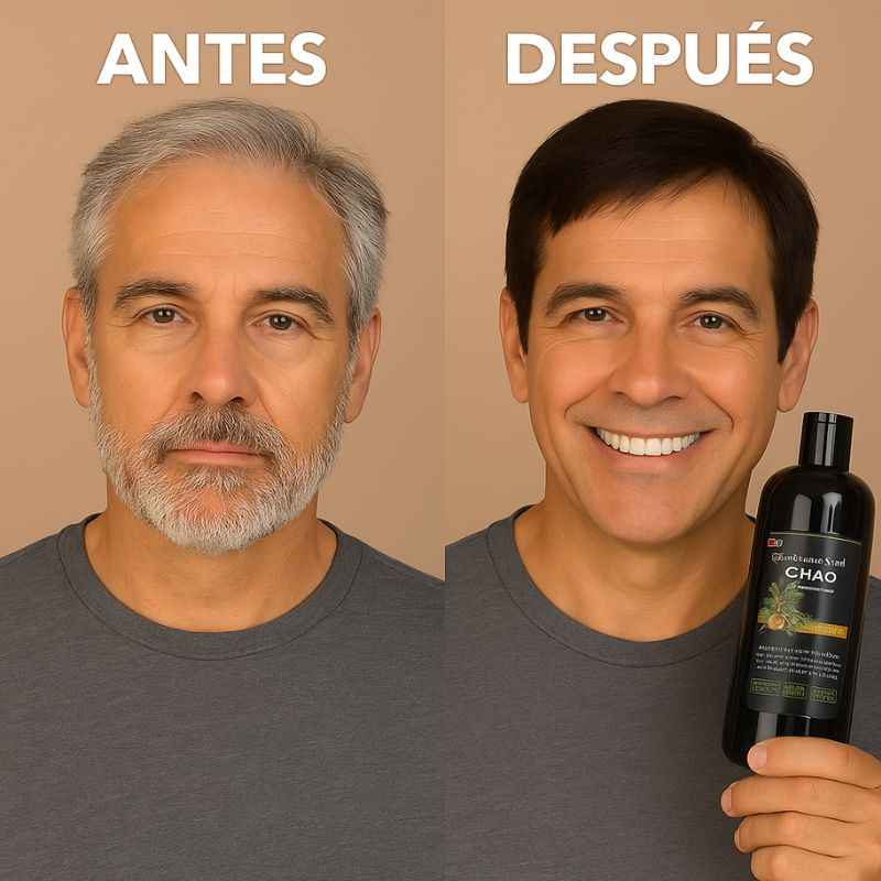 Shampoo Chao Canas+ 3 Regalos🎁