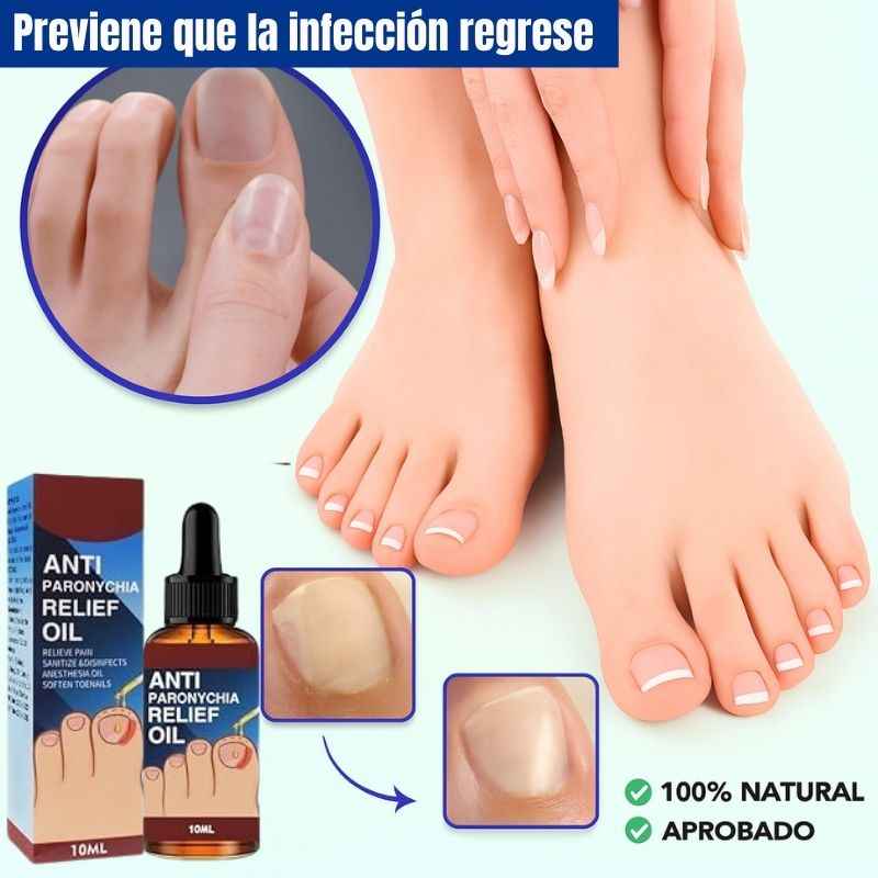 Tratamiento Profesional Anti-Hongos | Promo 2X1