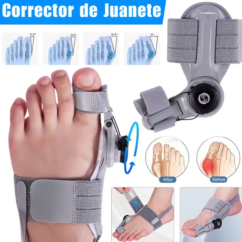 BunionFix™: Corrector ortopédico para juanetes