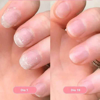 Nailix™: Lápiz para el crecimiento de uñas con células madre