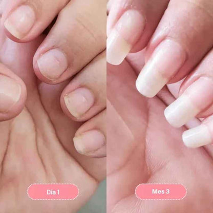 Nailix™: Lápiz para el crecimiento de uñas con células madre