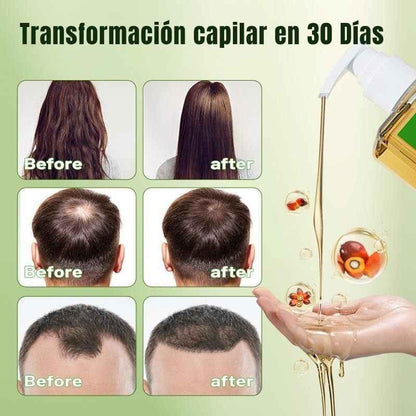 Gypsophila™: Champú de aceite de Batana y aceite de Romero