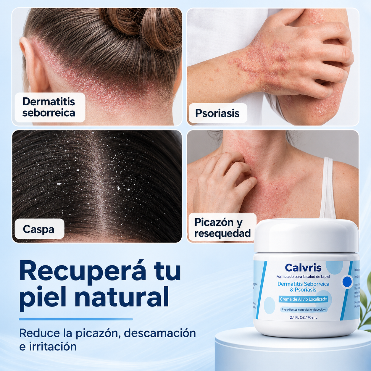 Tratamiento para el alivio de la psoriasis y la dermatitis aguda en 2 semanas