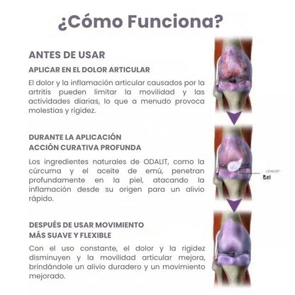 ODALIT® Gel de masaje calmante para artritis| Promo 2X1