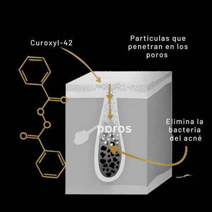 Shield™: Jabón Corporal para el Acné + Regalos