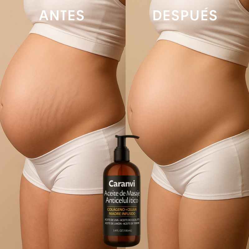 Caranvi™: Aceite reafirmante anticelulítico para mujeres