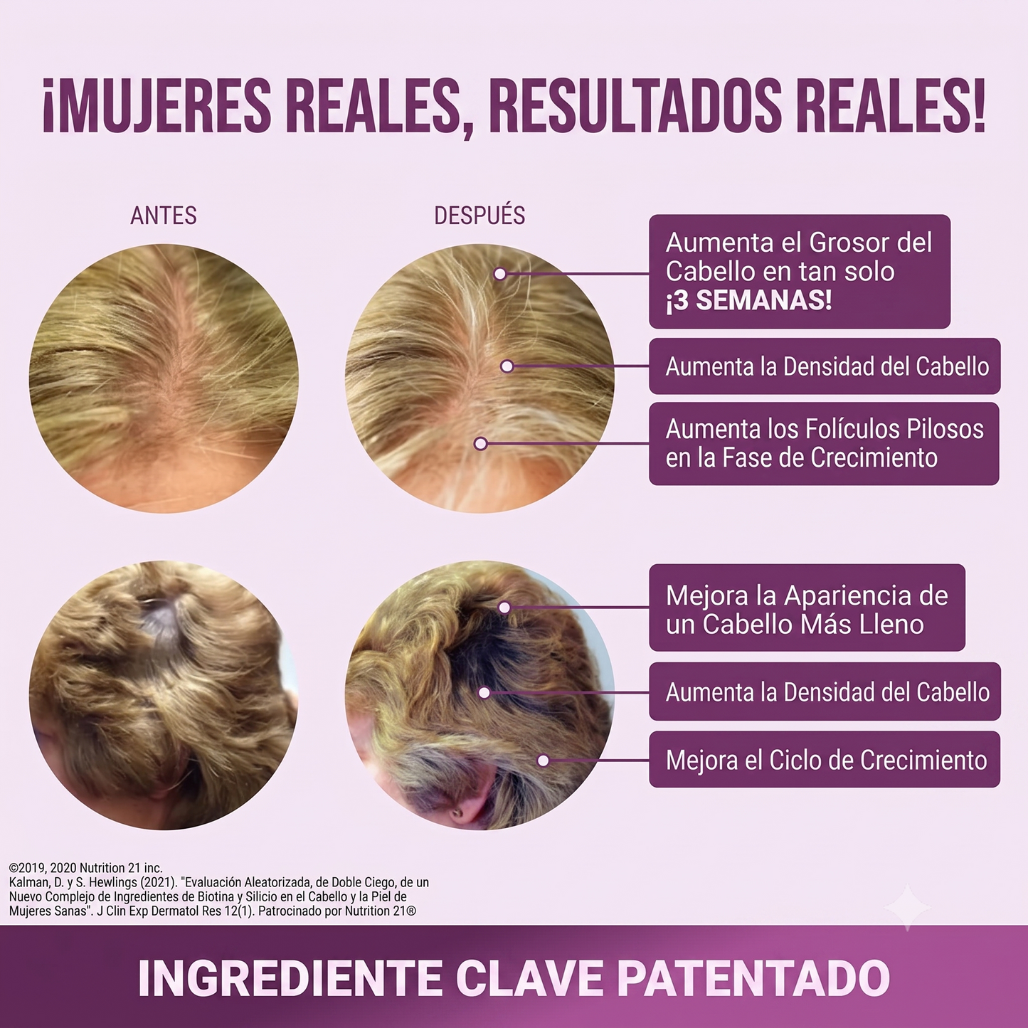 Suplemento para el crecimiento capilar avanzado