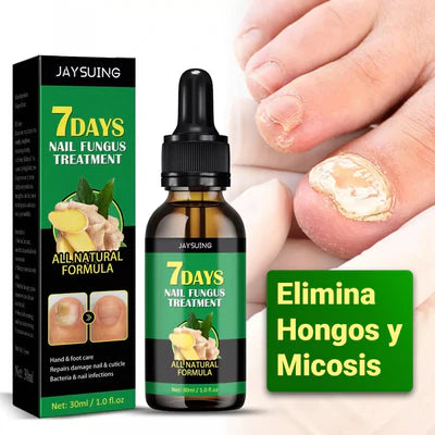 NailTreatment™: Tratamiento de hongos para las uñas | Paga 1 Lleva 2