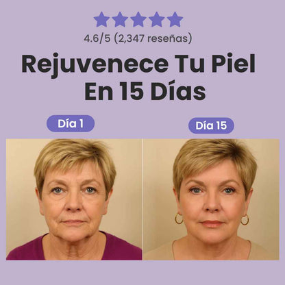 Lieva®: Tratamiento de Retinal | SkinCare Coreano
