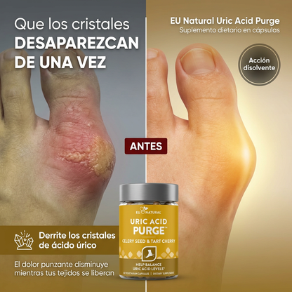 Eu Natural Uric Acid Purge