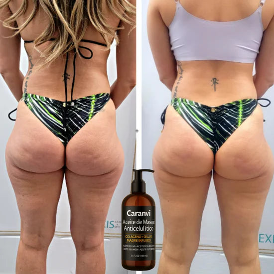 Caranvi™: Aceite reafirmante anticelulítico para mujeres